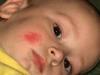 Image Thumbnail