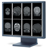 NEC 21.3" 2MP Grayscale Medical Grade LCD Display MD21GS-2MP-BKCB2, NEC brand