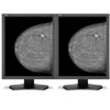 NEC 21" Grayscale 5-Megapixel Medical Diagnostic Monitors - $21317.14