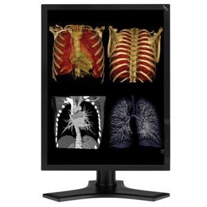 NEC MultiSync 21.3" Color 3-Megapixel Medical Diagnostic Monitor MD213MC