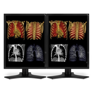 NEC Two 21" Color 3-Megapixel Medical Diagnostic Monitors MDC3MP-BNDL
