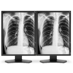 NEC Two 21" Grayscale 3-Megapixel Medical Diagnostic Monitors MDG3-BNDL1