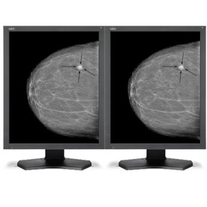 NEC 21" Grayscale 5-Megapixel Medical Diagnostic Monitors