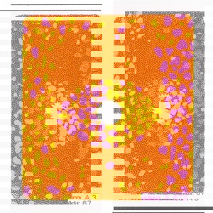  Cokin Yellow/Pink Center Spot Bocolor Filter Series A 