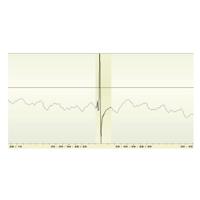 

CEDAR Audio CAM15 Manual Declick Module, Download