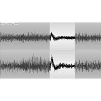 

CEDAR Audio CAM17 Dethump Module, Download