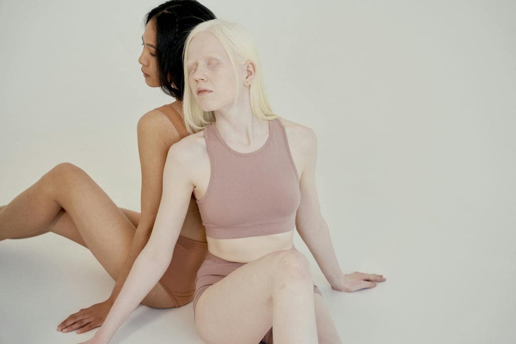 an albino woman posing in front of a black woman