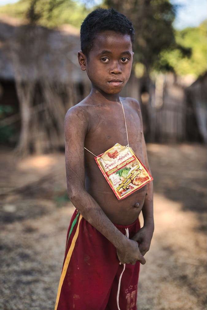 While many wear expensive fashion statements, this boy’s handbag is made with a chicken-flavoured cube wrapper and a piece of string.