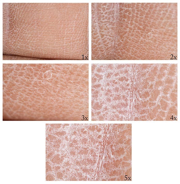 Canon MP-E 65/2.8 Macro Lens Magnification Examples