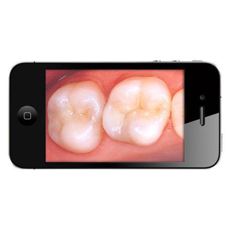 Hamilton Buhl INTR-C Wi-Fi Intraoral and Inspection Camera
