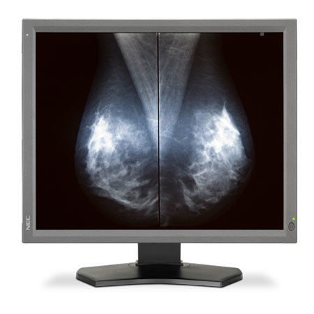 NEC MD211G5 21" 5MP LED-Backlit Medical Diagnostic Display