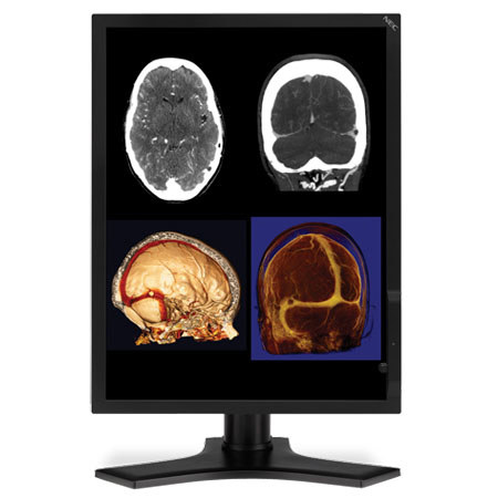 NEC 21" Color Medical Diagnostic Monitor