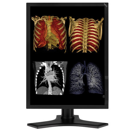 NEC MultiSync 21.3" Color Medical Diagnostic Monitor