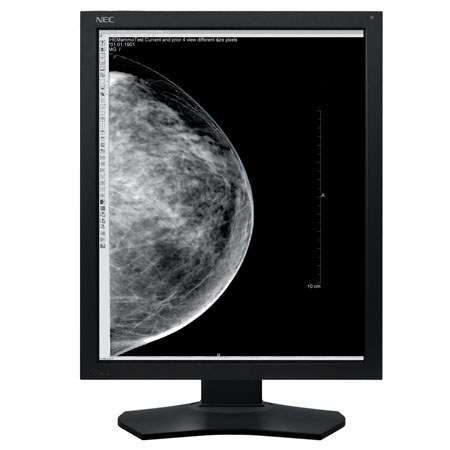 NEC MD215MG 21.3" Grayscale 5-Megapixel Medical Diagnostic Monitor