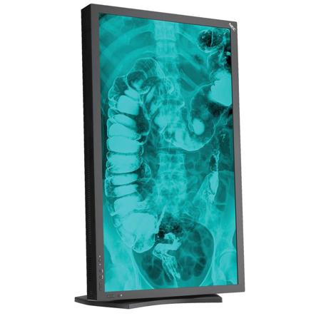 NEC MD322C8 32" 8MP 4K/UHD Medical Review LED Display Monitor