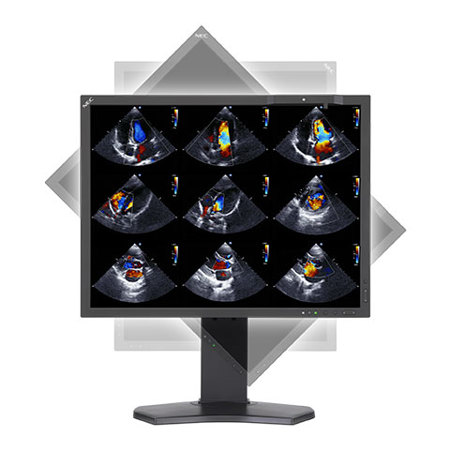 NEC 21.3" Self-Calibrating 2MP Medical Clinical Display with Integrated Sensor