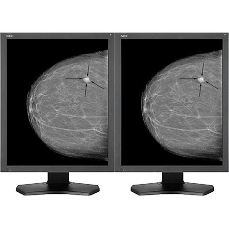 NEC MDG5-BNDL1 2 Fully Matched 21.3" Grayscale 5 MP Medical Diagnostic Monitors