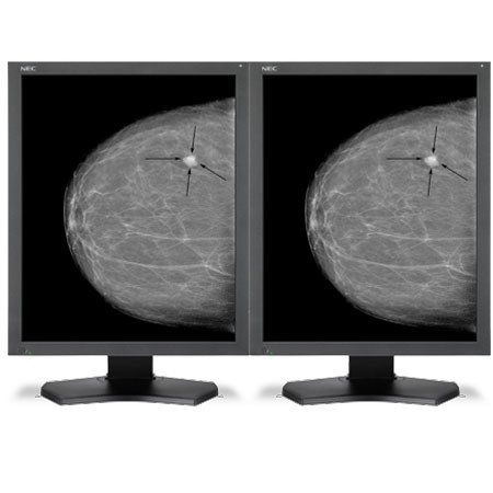 NEC 21" Grayscale 5-Megapixel Medical Diagnostic Monitors with Graphics Card