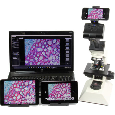 Bodelin Technologies ProScope 5MP WiFi & USB Microscope Camera