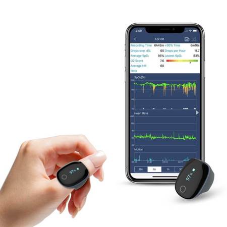 Wellue O2Ring Oxygen Monitor