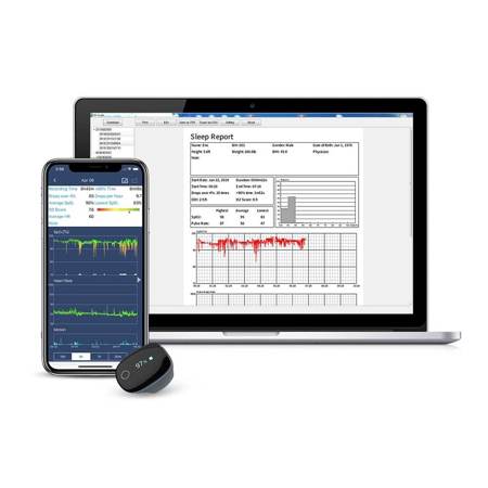Wellue O2Ring Oxygen Monitor