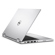 Dell Inspiron 11 3157: Picture 6 thumbnail