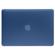Incase Hardshell Case for MacBook Pro Re...: Picture 5 thumbnail