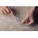Moshi iVisor: Picture 6 thumbnail