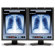 NEC (2) 21" Color 3MP LED-Backlit Medical Diagnostic Monitors with Graphics Card, 2048x1536 Resolution, 1000:1 Contrast Ratio, DVI-D/USB: Picture 2 thumbnail