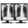 NEC (2) 21" Grayscale 3MP LED-Backlit Medical Diagnostic Monitors with Graphics Card, 2048x1536 Resolution, 900:1 Contrast Ratio, DVI-D/USB: Picture 2 thumbnail