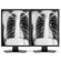 NEC Two 21" Grayscale 3-Megapixel Medical Diagnostic Monitors with Graphics Card, 2048x1536 Native Resolution, 12ms Response Time: Picture 2 thumbnail