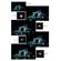 Tiffen North Star Effect: Picture 1 thumbnail