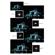 Tiffen 4x5.65" Hyper Star Effect Glass F...: Picture 2 thumbnail