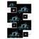 Tiffen 72mm Hyper/FX Special Star Effect...: Picture 1 thumbnail