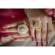 TAMRON 70-180mm F/2.8 Di III VC VXD G2 L...: Picture 6 thumbnail