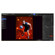 Westcott PhotoKey 5 Pro Software for Mac & Windows: Picture 1 thumbnail
