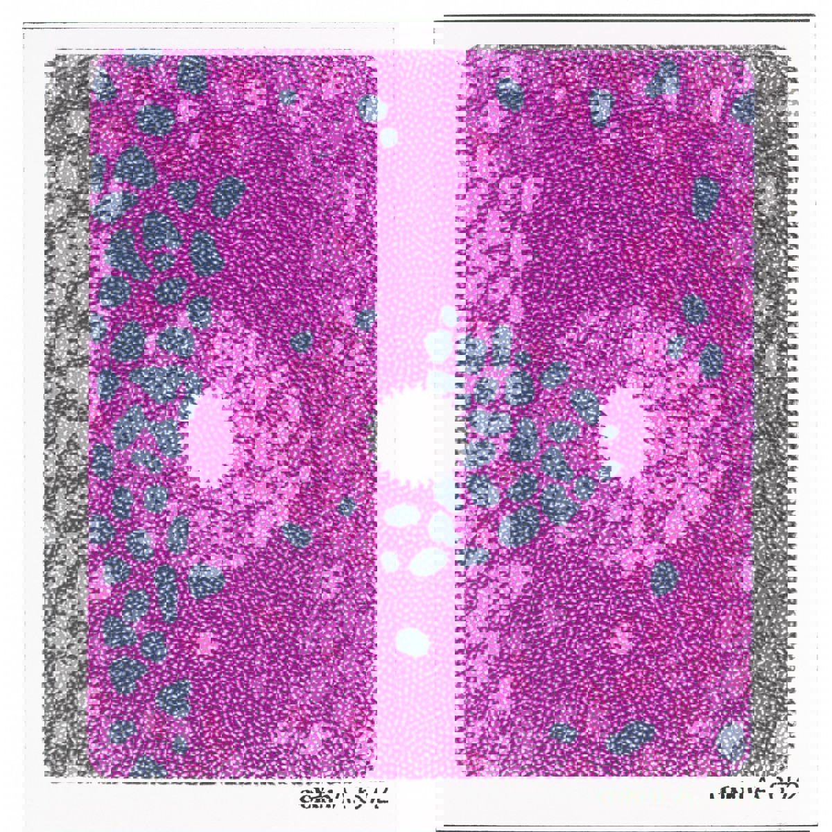 

Cokin A672 Pink/Blue Center Spot Bicolor Filter A-Series